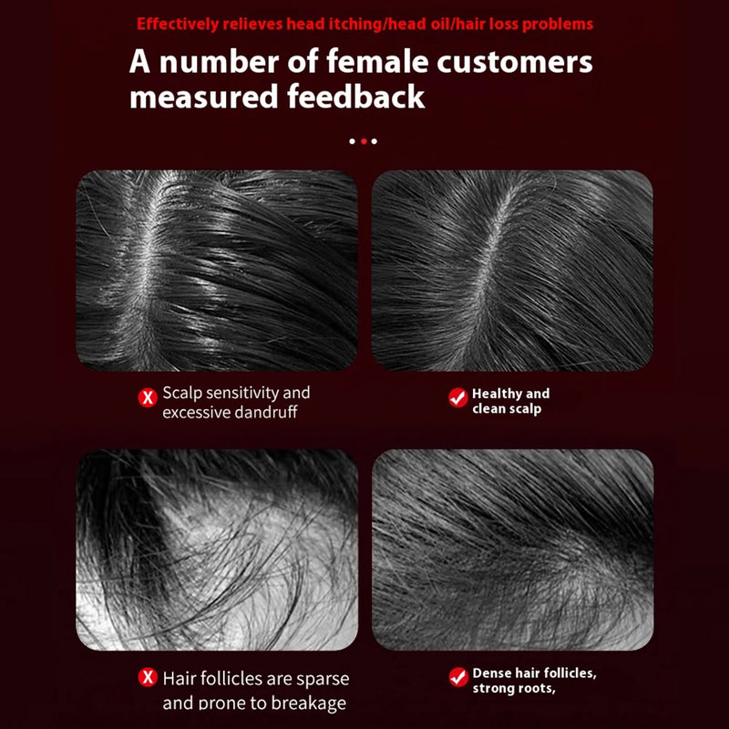 Advanced Laser Hair Therapy Massage Comb 3 Modes